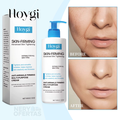 Crema Reafirmante Hoygi